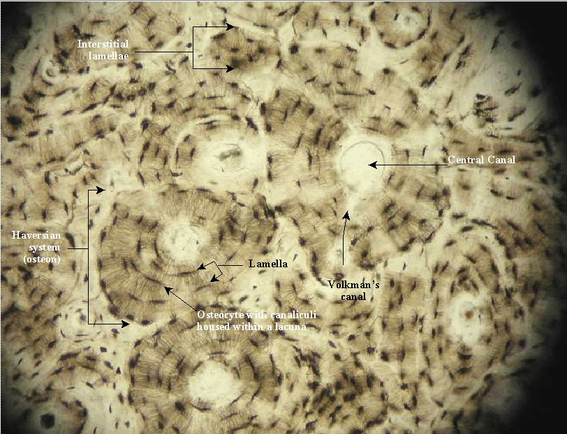 Bone tissue under microscope labeled